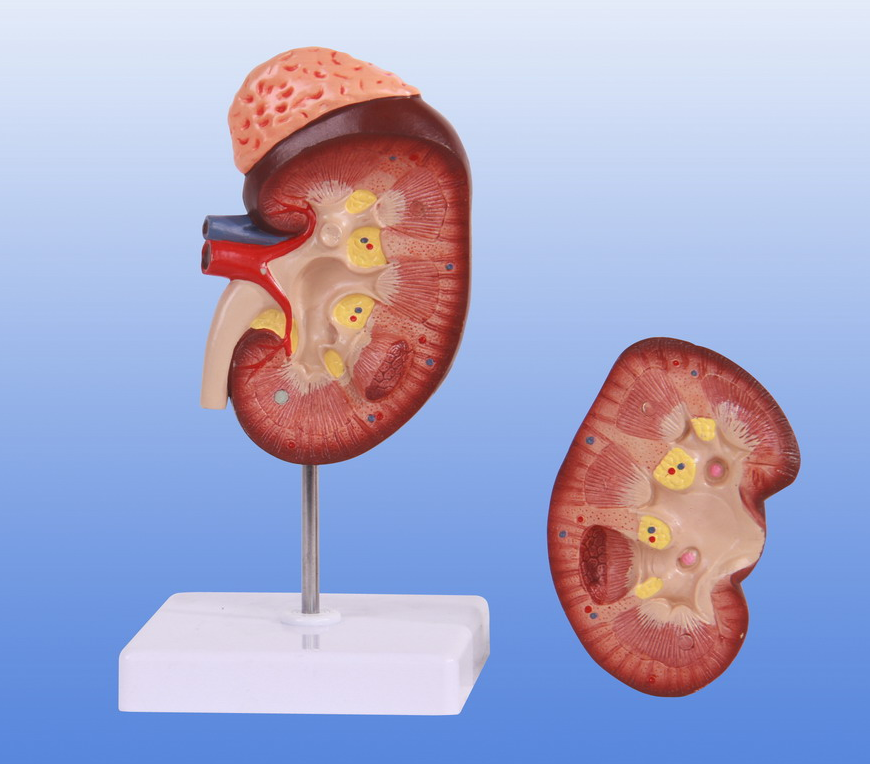 1.5倍大腎解剖模型